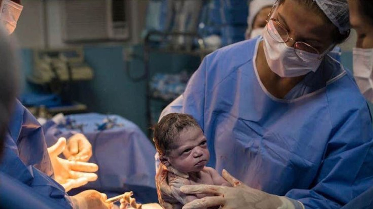 Sezaryen Doğum Nedir? Nasıl Gerçekleştirilir?