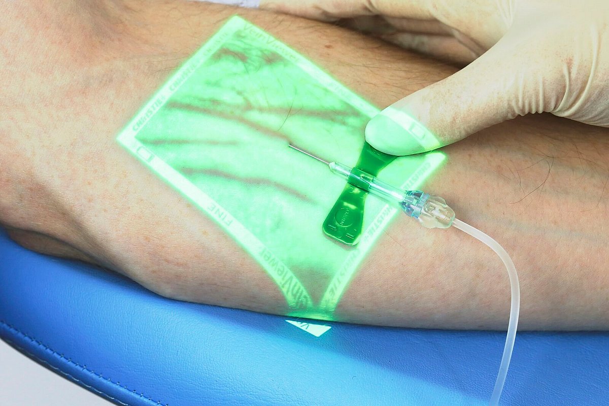 VeinViewer teknolojisi nedir?