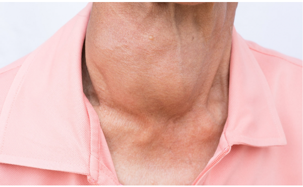 Tiroid Hastalığı nedir? Tiroid hastalığının türleri, belirtileri ve tedavi yöntemleri nelerdir? Tiroid hastalığı en çok kimlerde görülür? Tiroid hastalıklarından korunmak için neler yapılmalıdır?