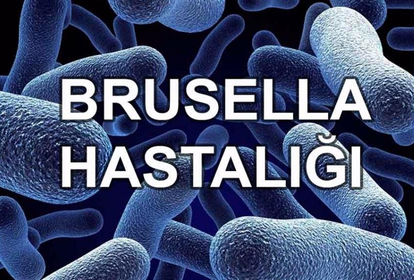 Brusella hastalığı nedir? Brusella belirtileri nedir? Brusella hastalığı ölümcül müdür? Brusella hastalığı bulaşıcı mıdır? Brusella hastaları nasıl beslenmeli? Brusella hastalığı tedavisi nedir?