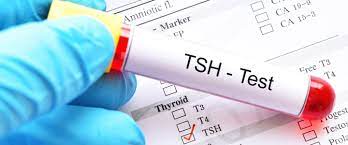 TSH nedir? TSH Ne İşe Yarar? TSH Testi Nedir? TSH Testi Ne Zaman Yapılır? Normal TSH Değeri Kaçtır?  TSH Yüksekliği Ne Anlama Gelir? TSH Yüksekliği Tedavisi nedir? TSH Düşüklüğü Ne Anlama Gelir? TSH Düşüklüğü ile Seyreden Hastalıklarda Tedavi Nasıldır?