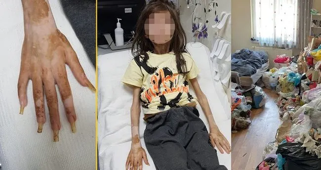 Bursa’da çöp evde bulunan Cem Muhammet’in son hali