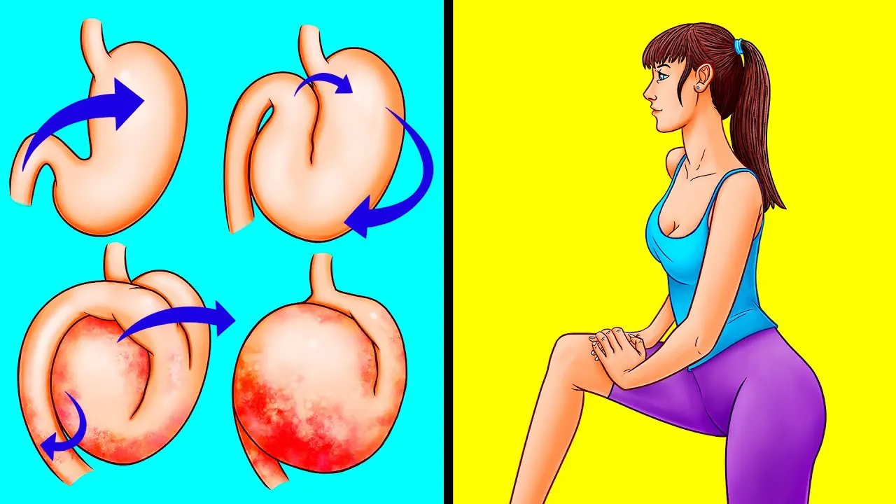 Mide Şişkinliği Nedir? Mide Şişkinliği Neden Olur? Mide Şişkinliği Belirtileri? Mide Şişkinliği Tedavisi? Mide Şişkinliğine Ne İyi Gelir?