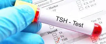 TSH nedir? TSH Ne İşe Yarar? TSH Testi Nedir? TSH Testi Ne Zaman Yapılır? Normal TSH Değeri Kaçtır? TSH Yüksekliği Ne Anlama Gelir? TSH Yüksekliği Tedavisi nedir? TSH Düşüklüğü Ne Anlama Gelir? TSH Düşüklüğü ile Seyreden Hastalıklarda Tedavi Nasıldır?